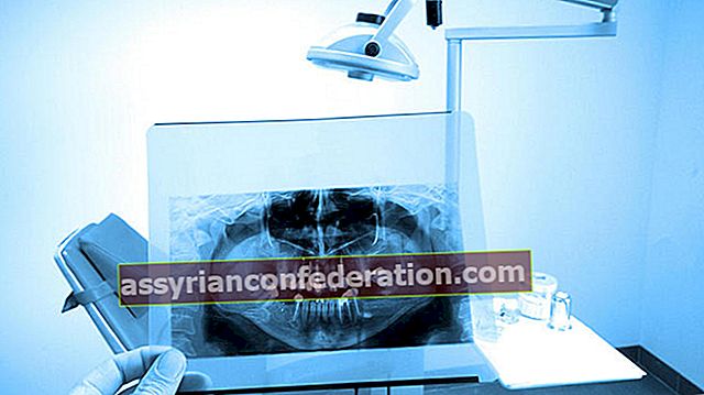 歯科用X線の放射線量はどれくらいですか？