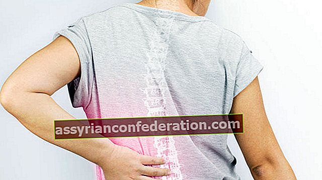 Sintomi e trattamento dell'osteoporosi (fusione delle ossa)