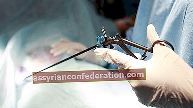 Vantaggi dei metodi laparoscopici in ginecologia