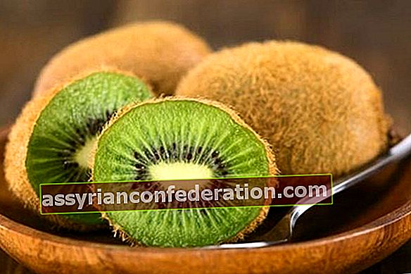 Benefici del kiwi